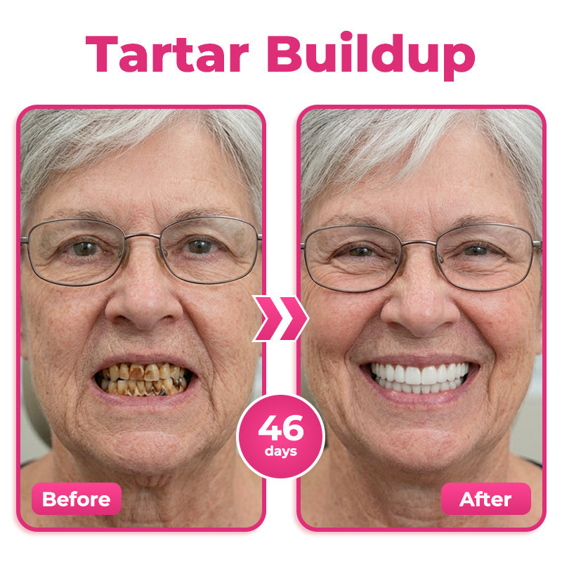 🇨🇦 🦷  Natravor® Thismile NH-10 Toothpaste Serum for Enamel & Gum Care – Advanced Therapypy