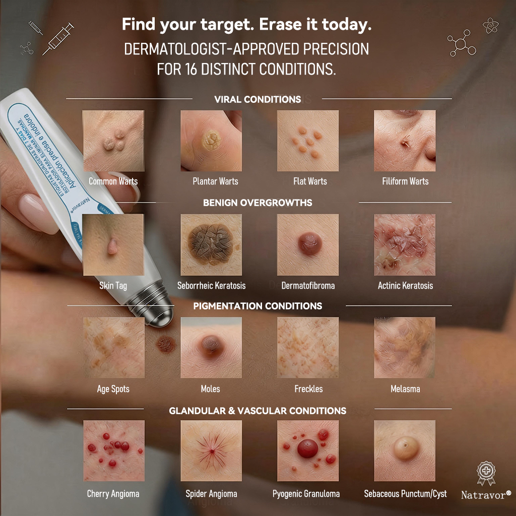 👩🏻‍⚕️𝐎𝐟𝐟𝐢𝐜𝐢𝐚𝐥 𝐁𝐫𝐚𝐧𝐝 𝐒𝐭𝐨𝐫𝐞 |✅Natravor® 7-𝐷𝑎𝑦 𝗧𝐚𝐠 & 𝗦𝗽𝐨𝐭 𝐄𝐫𝒂𝒔𝒆𝒓(Zero Pain, Zero 𝐒𝐜𝐚𝒓𝒔 Rollerball)