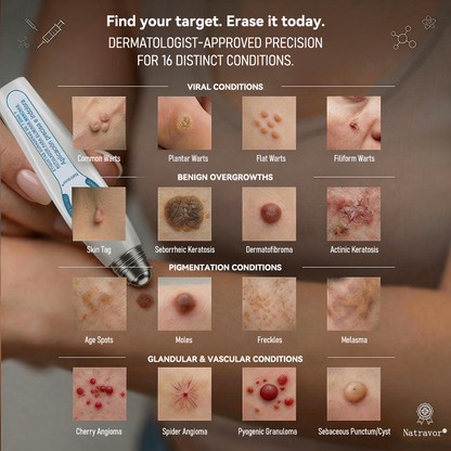 👩🏻‍⚕️𝐎𝐟𝐟𝐢𝐜𝐢𝐚𝐥 𝐁𝐫𝐚𝐧𝐝 𝐒𝐭𝐨𝐫𝐞 |✅Natravor® 7-𝐷𝑎𝑦 𝗧𝐚𝐠 & 𝗦𝗽𝐨𝐭 𝐄𝐫𝒂𝒔𝒆𝒓(Zero Pain, Zero 𝐒𝐜𝐚𝒓𝒔 Rollerball)