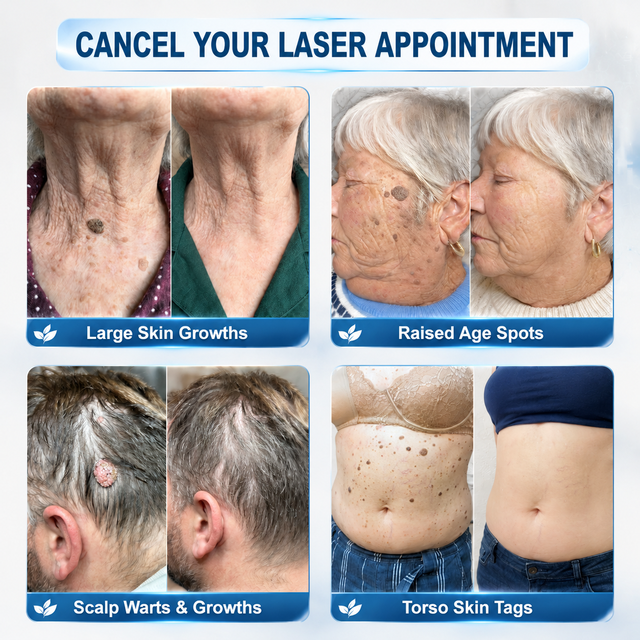 👩🏻‍⚕️𝐎𝐟𝐟𝐢𝐜𝐢𝐚𝐥 𝐁𝐫𝐚𝐧𝐝 𝐒𝐭𝐨𝐫𝐞 |✅Natravor® 7-𝐷𝑎𝑦 𝗧𝐚𝐠 & 𝗦𝗽𝐨𝐭 𝐄𝐫𝒂𝒔𝒆𝒓(Zero Pain, Zero 𝐒𝐜𝐚𝒓𝒔 Rollerball)